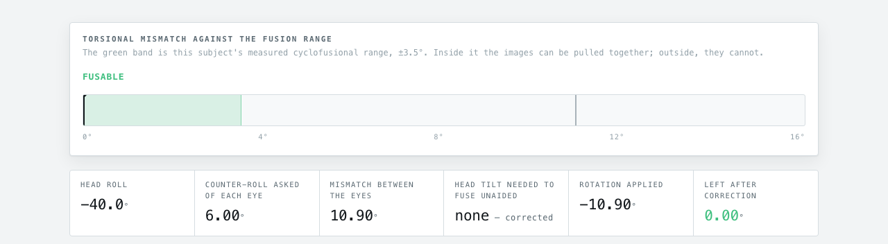 I switched the correction on. The headset pre-rotates what the right eye is shown by −10.90°, and what is left after correction is 0.00° — inside the green band, with no head tilt required.