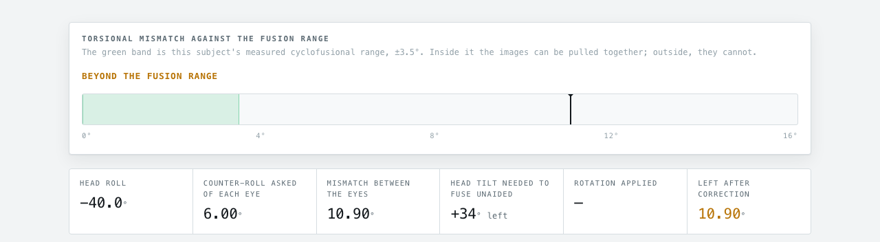 At 40° of right roll the mismatch is 10.90°, three times the fusion range. The readout also computes what it would take to fuse unaided: 34° of leftward head tilt.